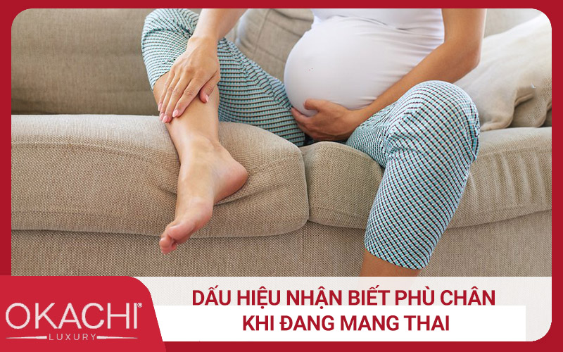 Dấu hiệu nhận biết phù chân khi đang mang thai