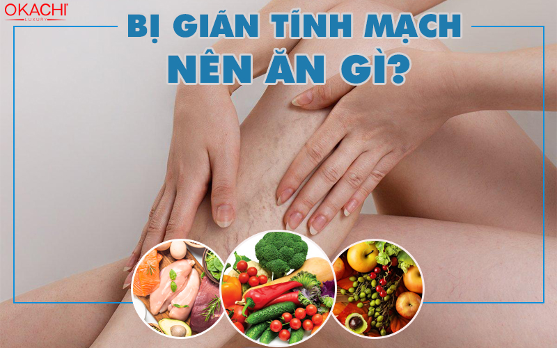 Bị giãn tĩnh mạch nên ăn gì?