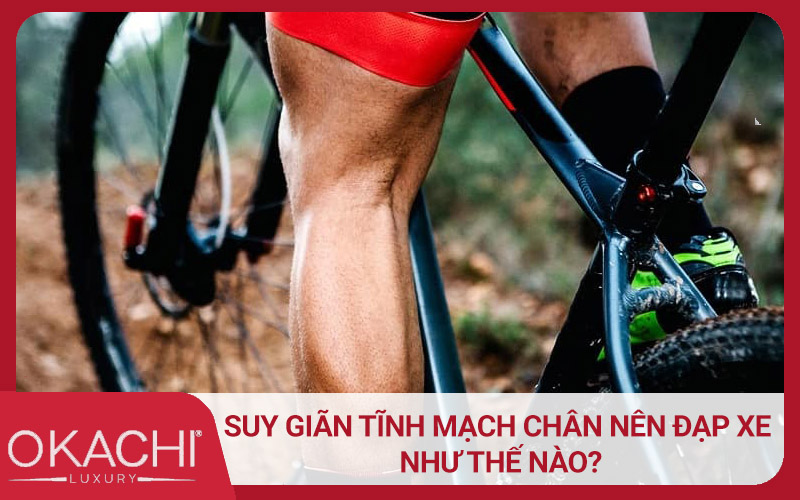 Suy giãn tĩnh mạch chân nên đạp xe như thế nào?