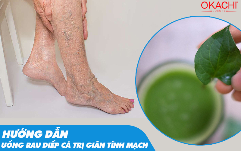 Uống diếp cá trị giãn tĩnh mạch TĂNG CƯỜNG sức khỏe