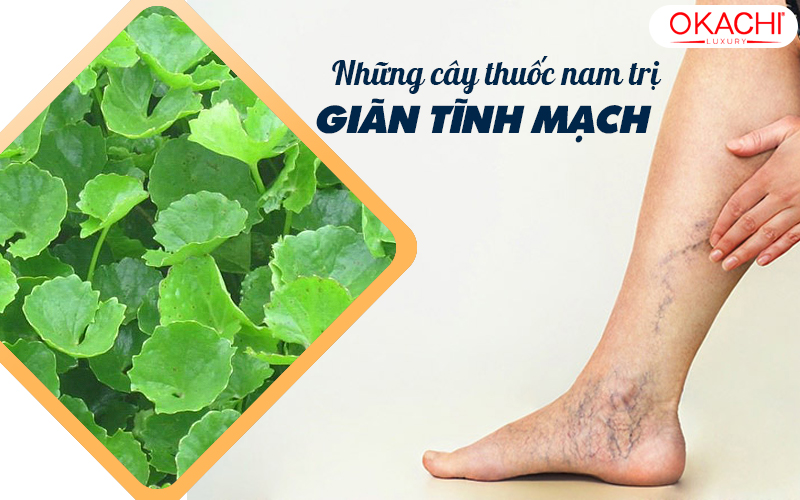 Cây thuốc nam chữa suy giãn tĩnh mạch cho MỌI NHÀ
