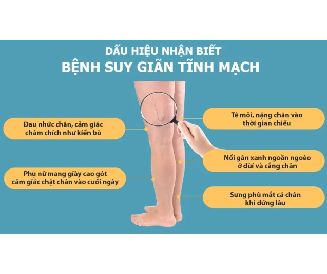 Phụ kiện phần chân máy nén ép suy giãn tĩnh mạch OKACHI6