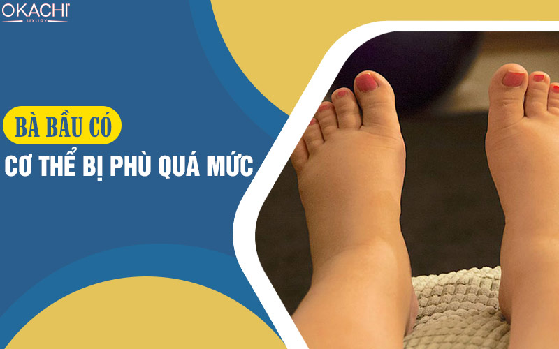 Bà bầu có Cơ thể bị phù quá mức