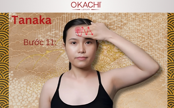 Bước 11:Thực hiện nâng cơ trán và kết thúc
