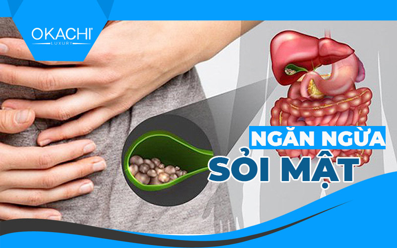 Ngăn ngừa sỏi mật