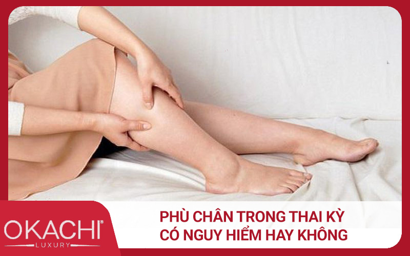 Phù chân trong thai kỳ có nguy hiểm hay không