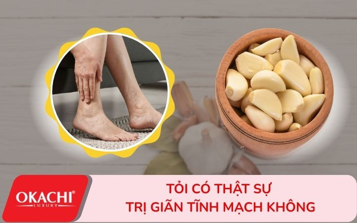 Tỏi có thật sự trị giãn tĩnh mạch không