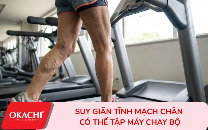 Các bài tập gym an toàn cho người suy tĩnh mạch