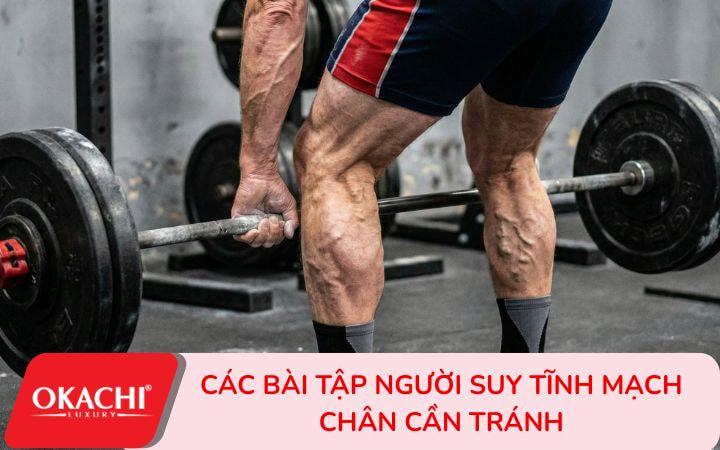 Các bài tập người suy tĩnh mạch chân cần tránh