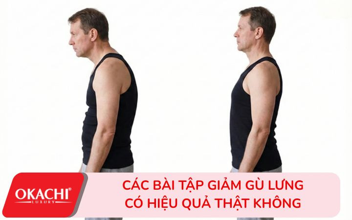 Các bài tập giảm gù lưng có hiệu quả thật không