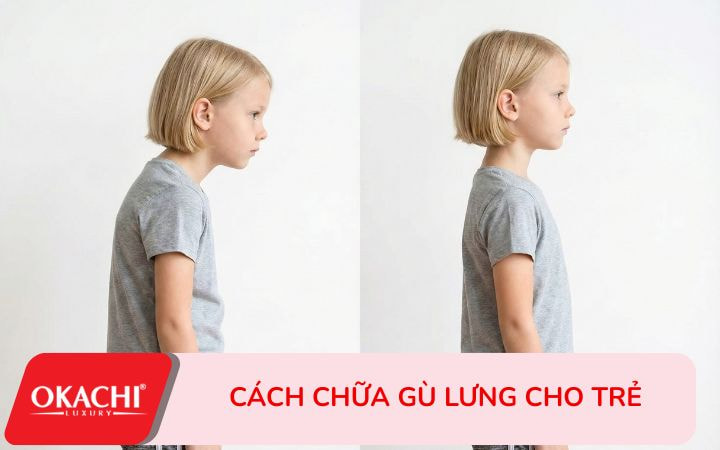 Cách chữa gù lưng cho trẻ