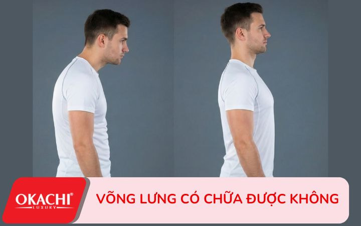 Võng lưng có chữa được không