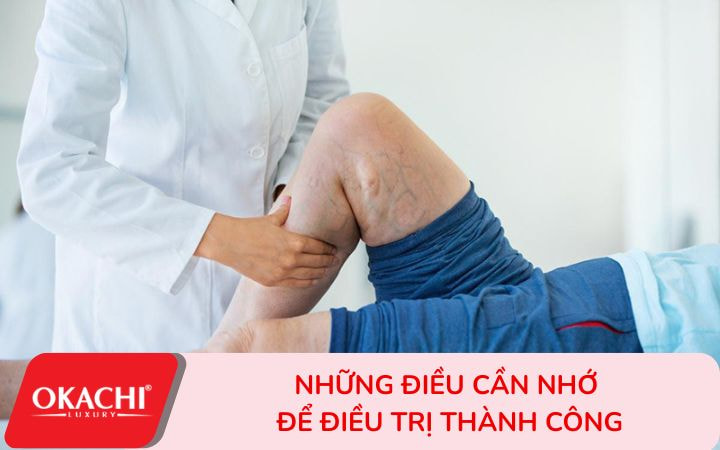 Những điều cần nhớ để điều trị suy giãn tĩnh mạch thành công