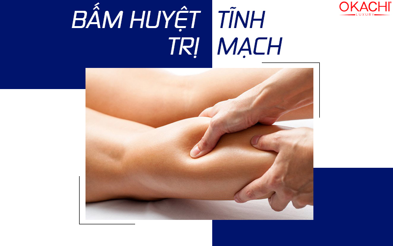bấm huyệt trị giãn tĩnh mạch