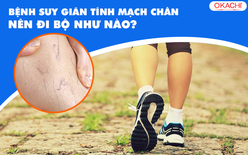 Bệnh suy giãn tĩnh mạch chân nên đi bộ như nào