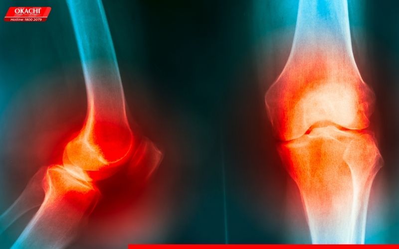 Bị đau khớp gối có nên đi bộ không