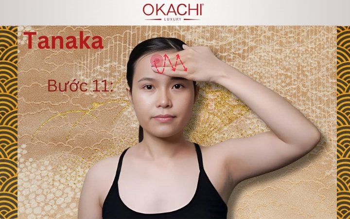 Bước 11:Thực hiện nâng cơ trán và kết thúc