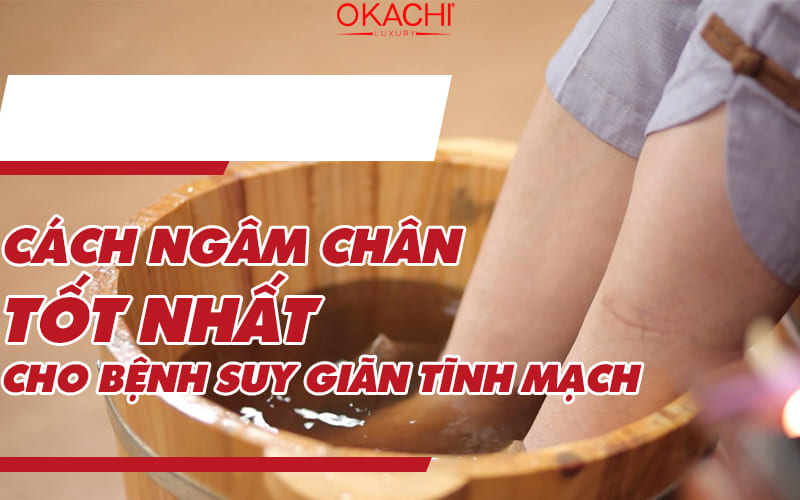 Cách ngâm chân tốt nhất cho bệnh suy giãn tĩnh mạch