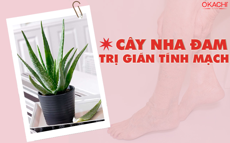 nha đam trị suy giãn tĩnh mạch