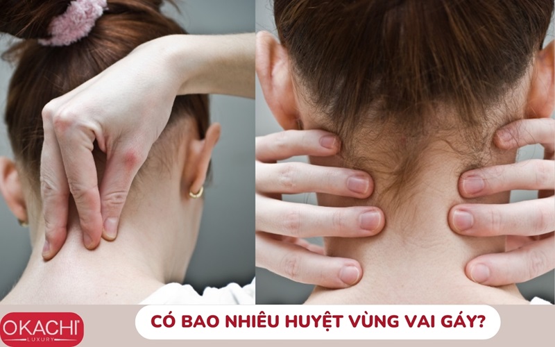 Có bao nhiêu huyệt vùng vai gáy