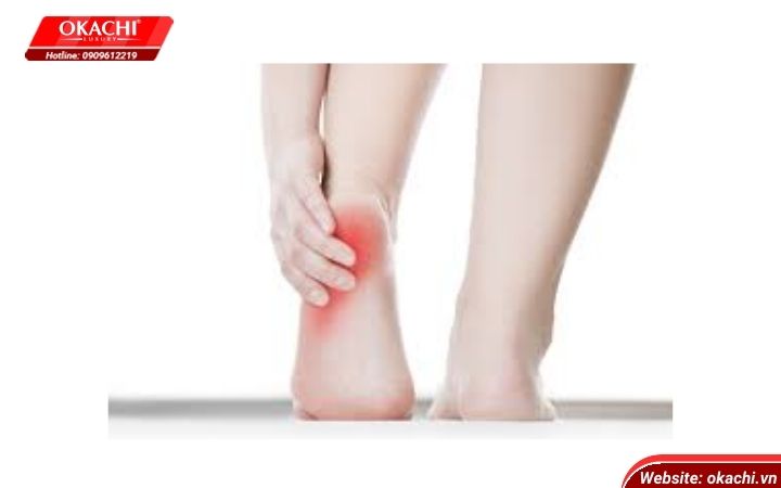 Đau cân gan chân trong chạy bộ