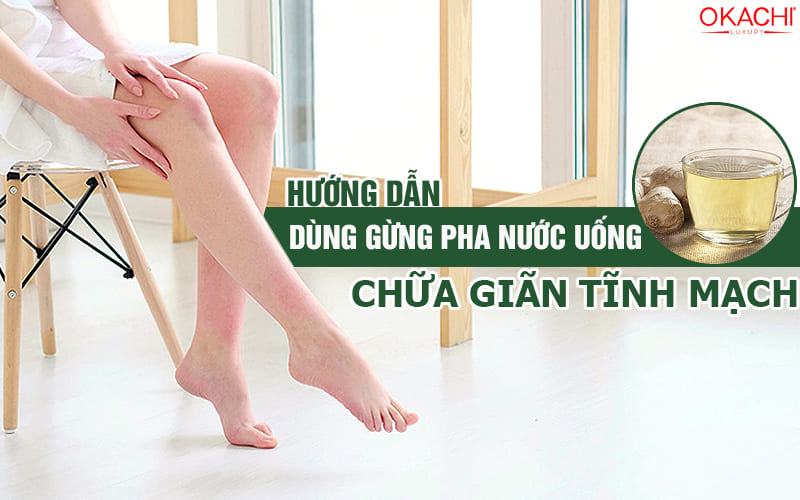 Hướng dẫn dùng gừng pha nước uống chữa giãn tĩnh mạch