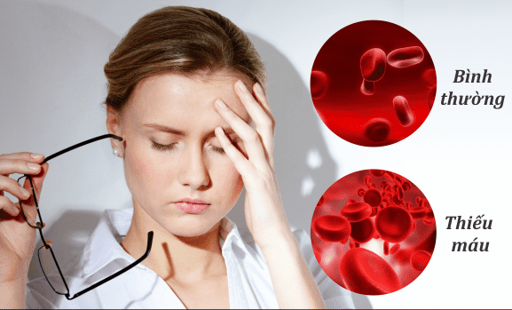 hình minh hoại máu bình thường và thiếu máu