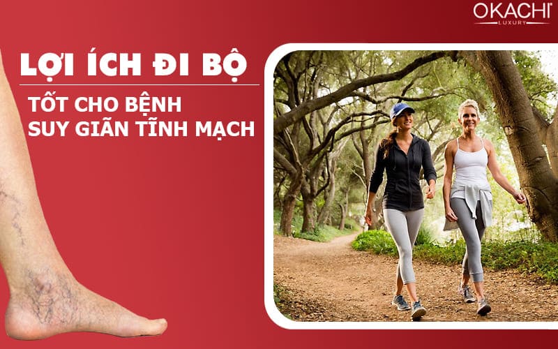 Lợi ích đi bộ tốt cho bệnh suy giãn tĩnh mạch.