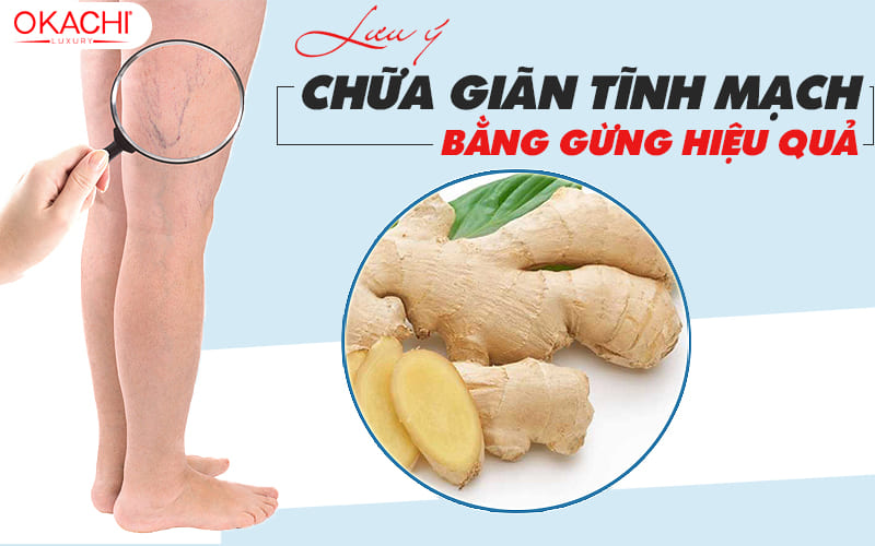 Lưu ý trị giãn tĩnh mạch bằng gừng hiệu quả