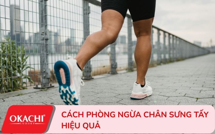 mẹo giảm chân phù nề ở người