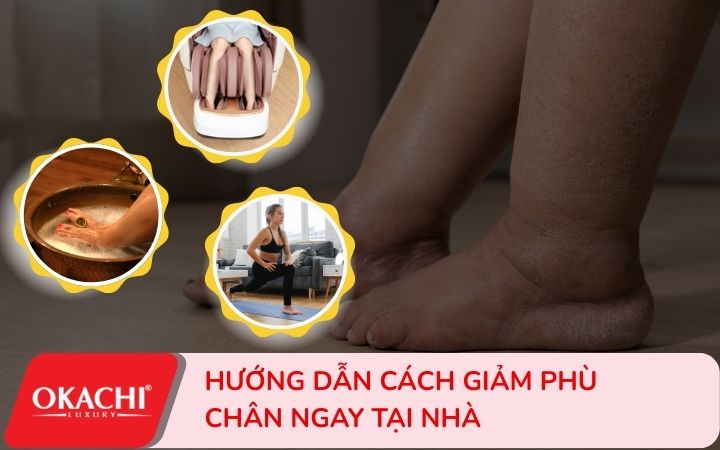 hướng dẫn cách giảm phù chân hiệu quả tại nhà
