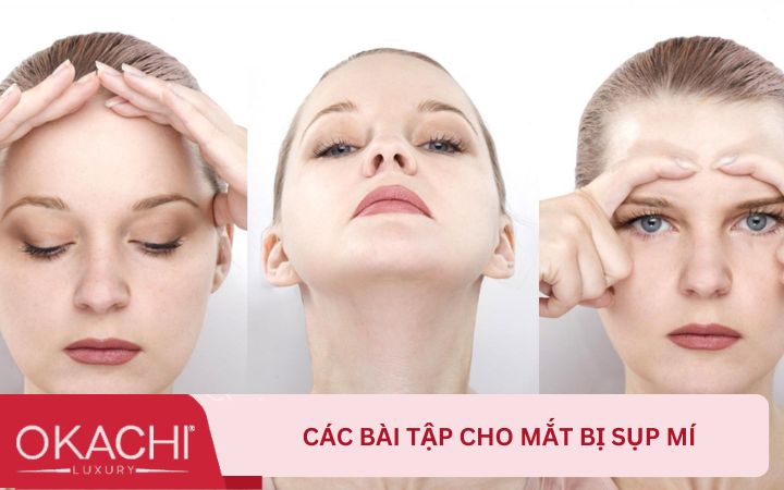 Các bài tập cho mắt bị sụp mí