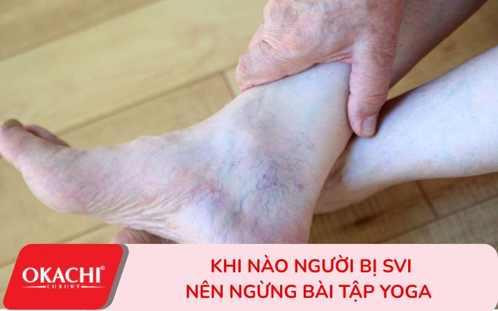 Khi nào nên ngừng bài tập yoga trị liệu suy giãn tĩnh mạch
