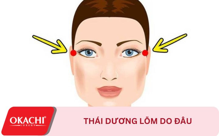Thái dương lõm do đâu