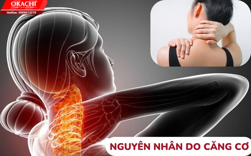 nguyên nhân do căng cơ
