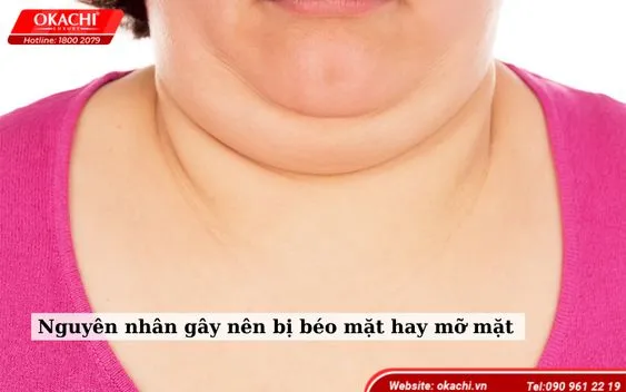 Nguyên nhân gây nên bị béo mặt hay mỡ mặt