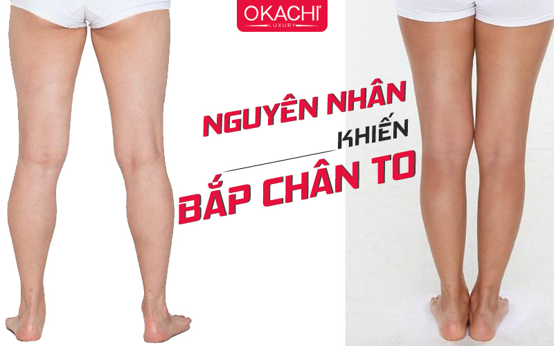 Nguyên nhân khiến bắp chân bị to