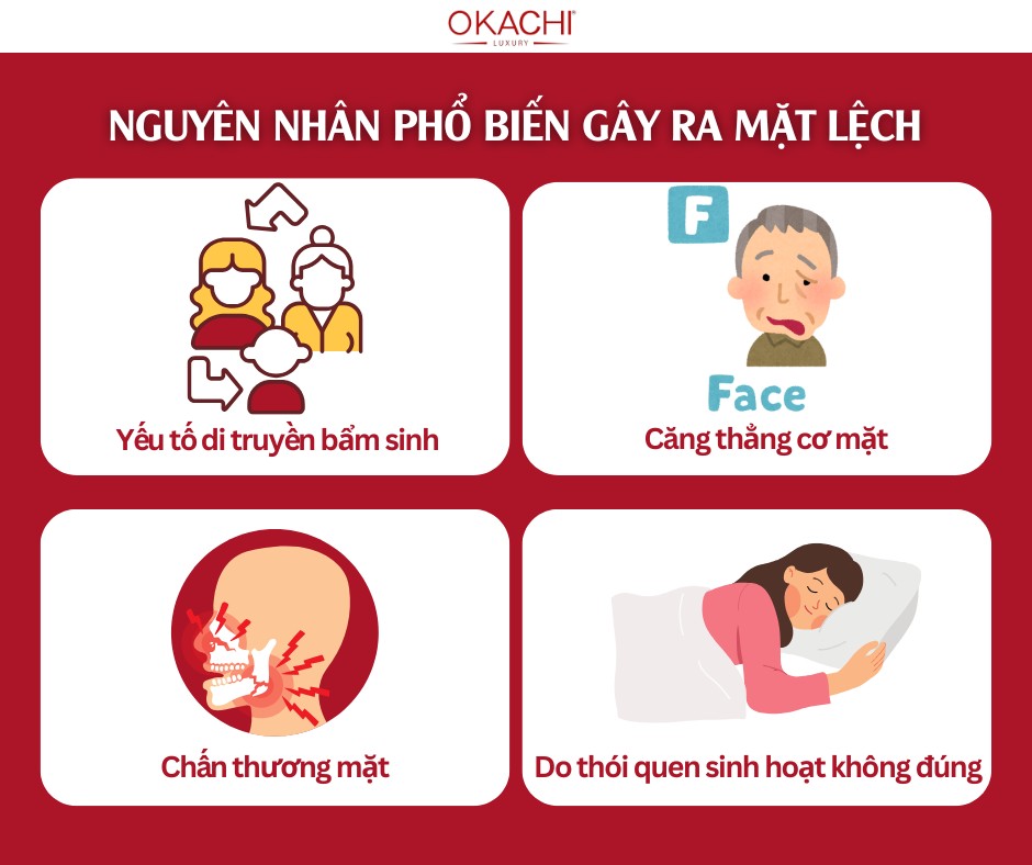 nguyen nhan pho bien gay ra mat lech