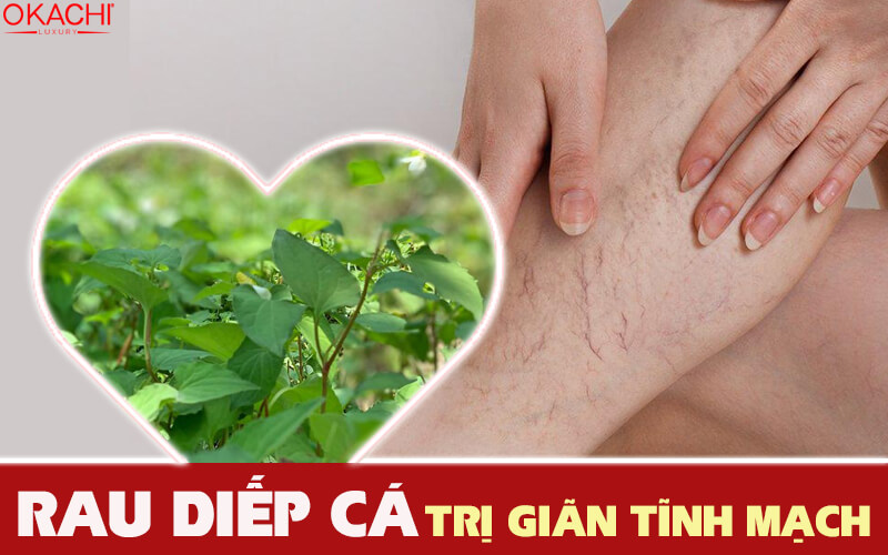 rau diếp cá trị suy giãn tĩnh mạch