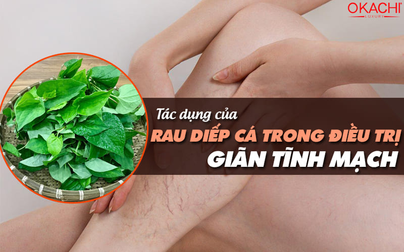 Tác dụng của rau diếp cá trong trị giãn tĩnh mạch