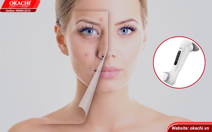Máy mát xa mặt hỗ trợ thải độc da hiệu quả