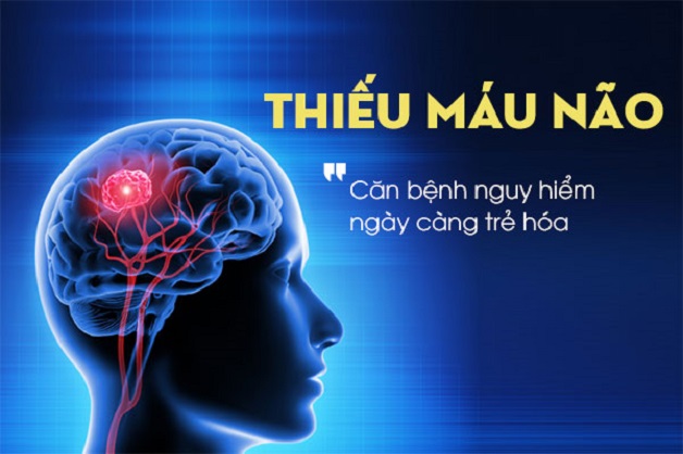 Sử dụng ghế massage giảm nguy co thiếu máu lên não