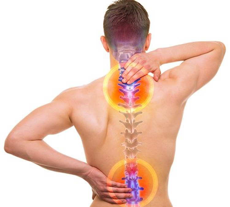 Thoái hóa cột sống