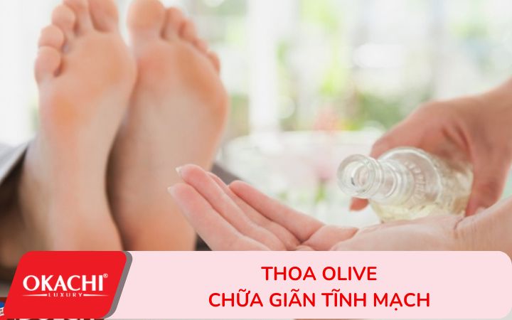 8 cách tự nhiên chữa giãn tĩnh mạch